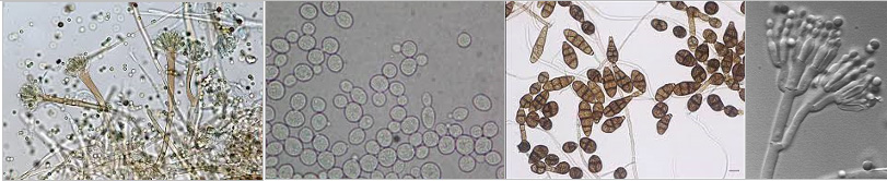  Imagens microscópicas de fungos presentes no ar